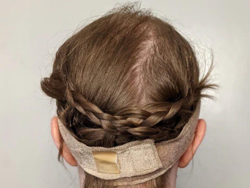 Tight wigs can lead to breakage
