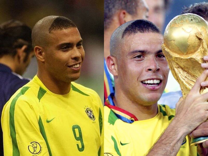 FAQs About R9 Haircut